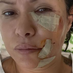 Köpeğin saldırdığı Tuğba Altıntop: Hayvanın suçu günahı yok