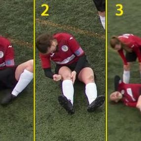 Diz kapağı çıkan kadın futbolcu maça devam etti