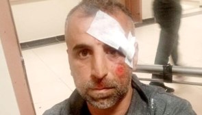 Adıyaman'da sokak köpeği saldırdığı iki kişiyi yaraladı