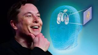 Elon Musk’ın çılgın projesi Neuralink nedir? İşte Neuralink hakkında bilmeniz gereken her şey