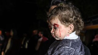 Korkutan senaryolar: Gazze'de ateşkes ilan edilse bile on binlerce kişi ölecek