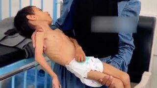 Gazze'de bir çocuk daha yetersiz beslenme nedeniyle yaşam savaşı veriyor