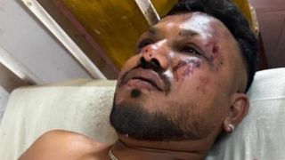 Hindistan'da uçak kazasından sağ kurtulan yolcu o anları anlattı