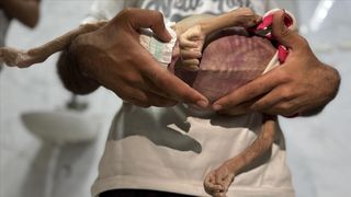 Gazze Şeridi'nde 24 saatte 1'i çocuk 14 Filistinli açlıktan hayatını kaybetti