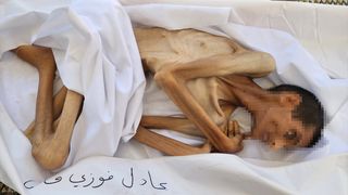 Açlık Gazze'de çocuk ve gençlerin kabusu oldu