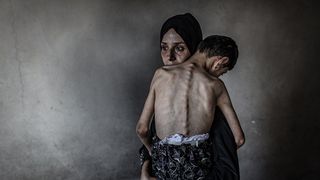 Gazze'de kıtlık: Son 24 saatte 4 sivil daha açlıktan hayatını kaybetti