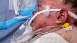 İsrail zulmünün utanç karesi: Gazze'de 10 aylık bebek ağır yaralandı