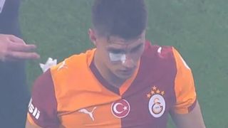 Kazımcan Karataş'a derbide yabancı madde geldi!