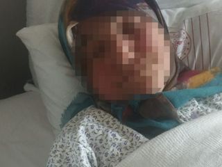 Ankara'da yorgun mermi isabet eden yaşlı kadın yaralandı