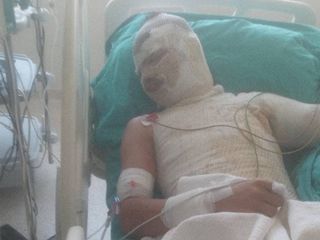 Adana'da yeğenini yakan saldırgan suçu ağabeyine attı
