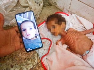 İsrail ablukası altındaki Gazze'de 3 aylık Curi de açlıktan can verdi