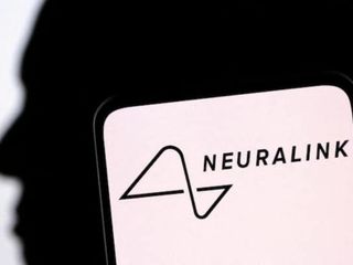 Elon Musk: Neuralink işitme kaybını düzeltebilir