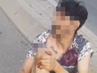 İstanbul Kadıköy'de motosiklet kazasında yaralanan genç feryat etti: Çok borcum var