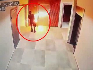 Batman'da faciayı ucuz atlattı: Elektrikli skuterinin bataryası elinde patladı