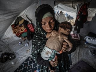 Gazze'de açlıktan ölenlerin sayısı artıyor