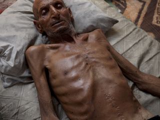 Gazze'de soykırım: 75 yaşındaki adam 40 kiloya düştü