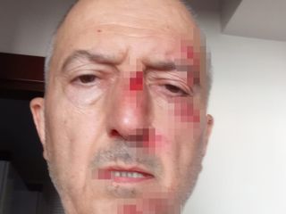 Afyonkarahisar'da karısı evlerini satınca evsiz kaldı: Ardından darp edildi