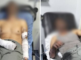 Manisa'da oto tamirhanesinde patlama: 2 kişi ölümden döndü