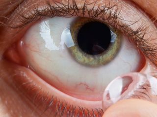 Kontakt lens kullanıyorsanız bu 6 kuralı uygulayın: Hayat kurtarıyor