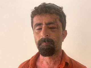 Antalya'da babaevine dönen eşini takip etti: Tartıştığı kayınpederini darbetti