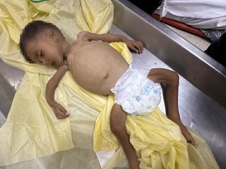 Gazze'de gıda krizi: Son 24 saatte 8 kişi daha açlıktan hayatını kaybetti