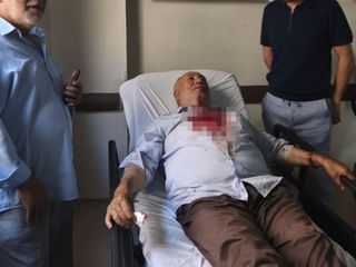 Iğdır'da kavgayı ayırmak isteyen imam yumruk yedi