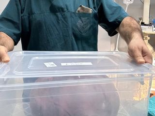 Trabzon'da yumurtalıklarından 9 kiloluk kitle çıktı
