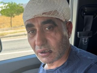 Afyonkarahisar'da eğlence merkezi çıkışında görevliler tarafından darbedildi
