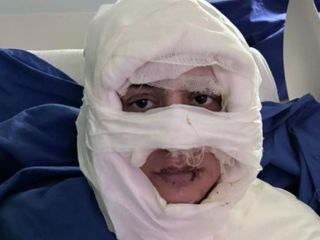 Kadıköy'de genç kadın, başka bir kadın tarafından ateşe verildi