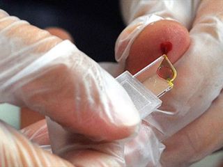 Yeni kan grubu üretiliyor: Sadece 50 kişide var