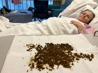 Manisa'da safra kesesinden 20 binin üzerinde taş çıktı