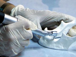 SGK implant tedavisini karşılıyor mu? Ücretsiz implant şartları 2025
