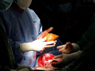 ABD'de kuduzlu böbrek nakli yapıldı: Hayatını kaybetti