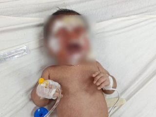 Şanlıurfa'da kendiliğinden yanan ev: 2 aylık bebek yanarak yaralandı