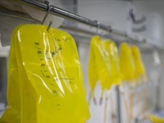 Serum tedavisi hakkında doğru bilinen yanlışlar