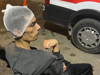 Gaziantep’te engelli bakım merkezinde şiddet: Gencin başına 6 dikiş atıldı