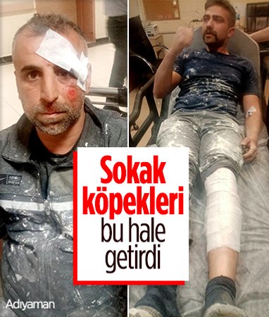 Adıyaman'da sokak köpeği saldırdığı iki kişiyi yaraladı