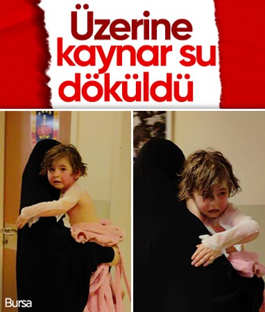 Bursa’da 4 yaşındaki Suriyeli çocuğun üzerine kaynar su döküldü