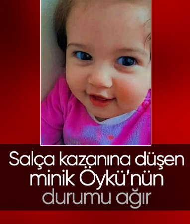 Muğla'da salça kaynatılan kazana düşen minik Öykü'nün hayati tehlikesi sürüyor