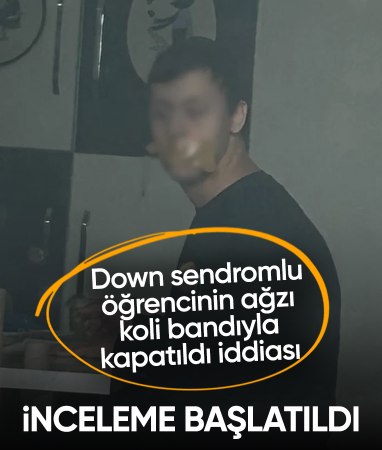 Bursa'da down sendromlu öğrencinin ağzının koli bandı ile kapatıldığı fotoğrafa inceleme