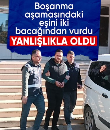 Kırıkkale'de boşanma aşamasındaki eşini iki bacağından vurdu