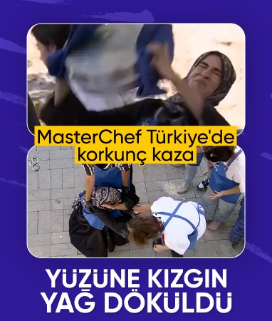 MasterChef Türkiye'de Beyza'nın yüzü yandı: Görüntüler ortaya çıktı