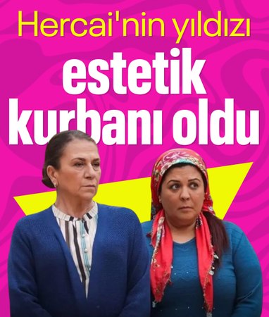 Oyuncu Eylem Tanrıver, estetik yaptırdıktan sonra felç kaldı