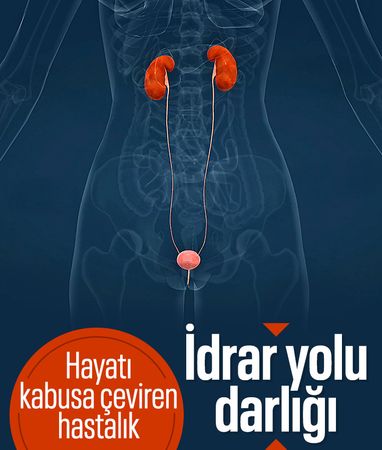 İnsanı sosyal hayattan koparan hastalık: İdrar yolu darlığı