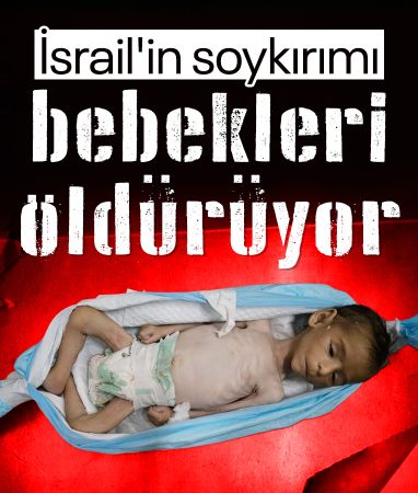 Gazze’de iki bebek daha açlığa yenik düştü