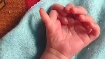 Hindistan'da şaşkına çeviren olay: 26 parmağı olan bebek dünyaya geldi