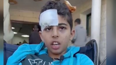 Filistinli yaralı çocuk, Cumhurbaşkanı Erdoğan'dan yardım istedi: Kolum çok sızlıyor...