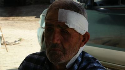 Kocaeli'de yaşlı çobana başıboş köpek saldırdı