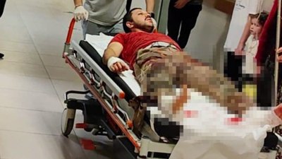 Bursa'da feci kaza! Odun keserken iki ayağını ve elini kesti