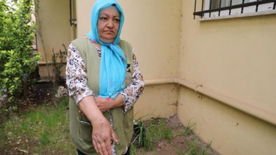 Sakarya'da köpek saldırısına uğrayan kadın o anları gözyaşlarıyla anlattı